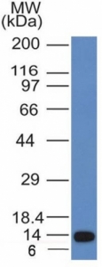 Western blot analysis of a recombinant protein fragment of ALK using Anaplastic Lymphoma Kinase antibody (clone ALK/1031).