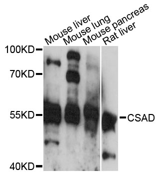 Anti-CSAD Antibody