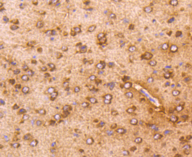Anti-AKT1 Antibody [Assigned #A11027]