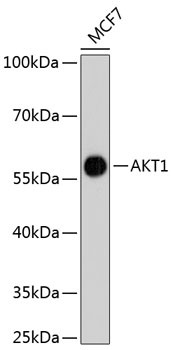 Anti-AKT1 Antibody [Assigned #A11027]