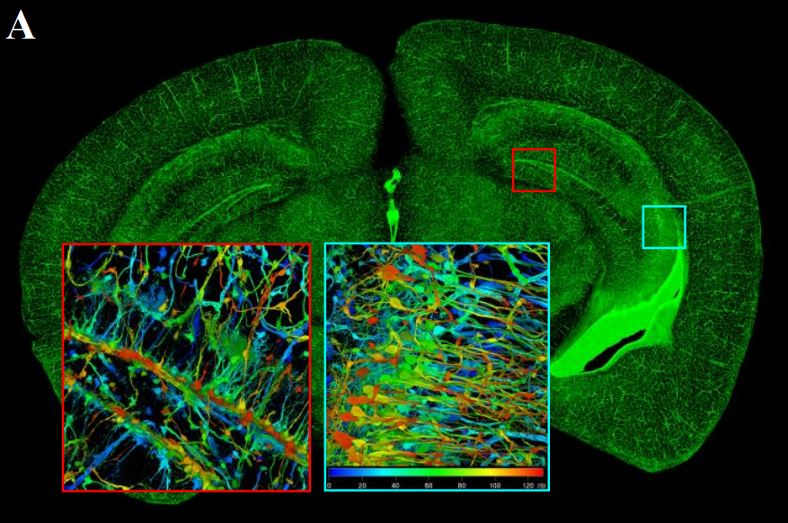 A mouse brain slice.