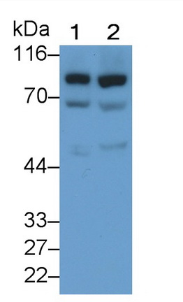 Western Blot; Sample: Lane1: HepG2 cell lysate; Lane2: SW480 cell lysate<br/>Primary Ab: 1µg/ml Rabbit Anti-Human GUSb Antibody<br/>Second Ab: 0.2µg/mL HRP-Linked Caprine Anti-Rabbit IgG Polyclonal Antibody<br/>(Catalog: SAA544Rb19)