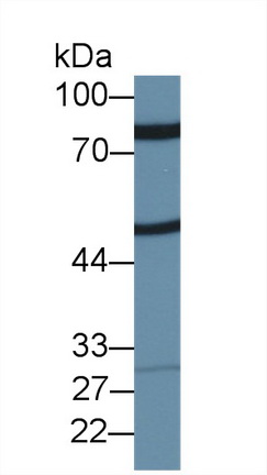 Western Blot; Sample: Rat Placenta lysate; Primary Ab: 1µg/ml Rabbit Anti-Rat ZP2 Antibody Second Ab: 0.2µg/mL HRP-Linked Caprine Anti-Rabbit IgG Polyclonal Antibody