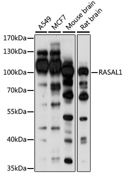 Anti-RASAL1 Antibody