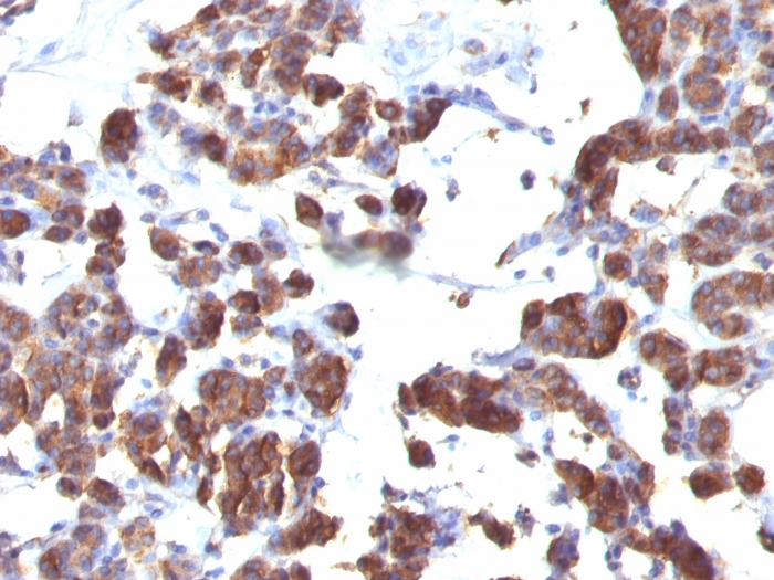 Anti-Thyroglobulin Antibody [TGB04 + TGB05]