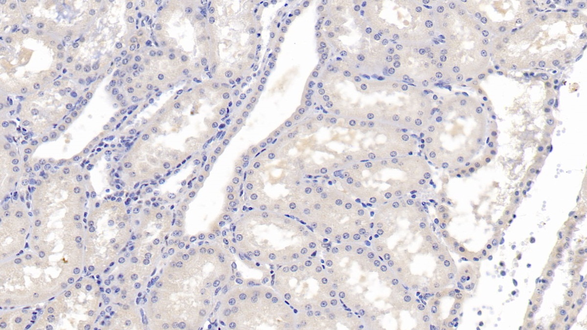 DAB staining on IHC-P; Samples: Human Kidney Tissue;  Primary Ab: 20µg/ml   Mouse Anti-Human SCCA1/SCCA2 Antibody Second Ab: 2µg/mL HRP-Linked Caprine Anti-Mouse IgG Polyclonal Antibody (Catalog: SAA544Mu19)