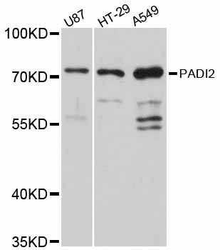 Anti-PADI2 Antibody