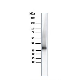 Western blot testing of human kidney lysate with Adiponectin antibody. Predicted molecular weigth ~30 kDa.