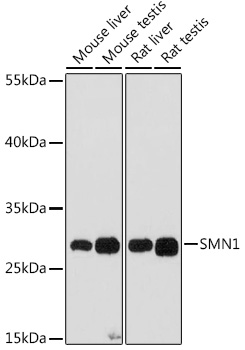 Anti-SMN1 Antibody