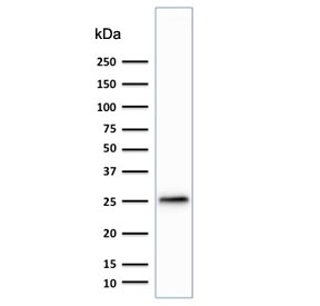 Western blot testing of human brain lysate with anti-PGP9.5 antibody (clone SPM574). Predicted molecular weight ~25 kDa.