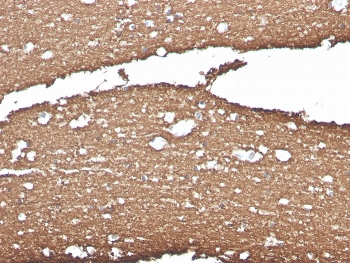 IHC staining of FFPE human brain with Myelin Basic Protein antibody (clone MBP/4275). HIER: boil tissue sections in pH 9 10mM Tris with 1mM EDTA for 20 min and allow to cool before testing.