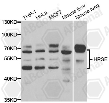 Anti-HPSE Antibody
