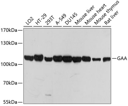 Anti-GAA Antibody