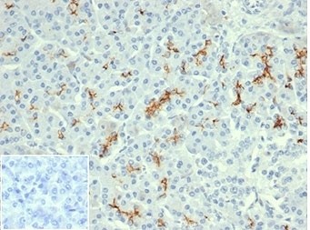 IHC staining of FFPE human pancreatic tissue with recombinant Cystic Fibrosis Transmembrane Regulator antibody (clone rCFTR/6476). Negative control inset: PBS used instead of primary antibody to control for secondary Ab binding. HIER: boil tissue sections in pH 9 10mM Tris with 1mM EDTA for 20 min and allow to cool before testing.