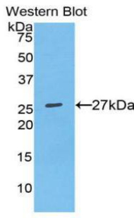 Western Blot; Sample: Recombinant protein.