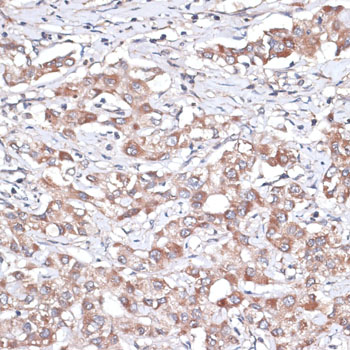 Anti-TGFBR2 Antibody