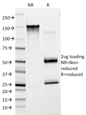 Anti-Von Willebrand Factor Antibody [F8/86]