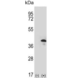 Western blot testing of 1) non-transfected and 2) transfected 293 cell lysate with ZWINT antibody. 