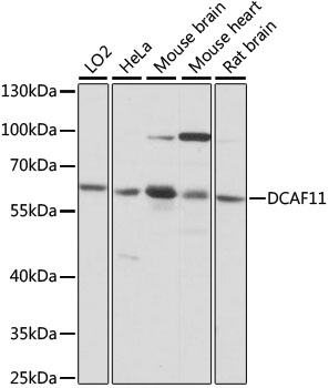 Anti-DCAF11 Antibody