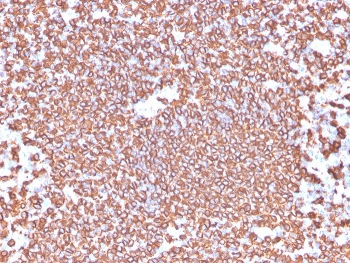 IHC testing of FFPE human tonsil tissue with recombinant CD20 antibody (clone IGEL/4524R). HIER: boil tissue sections in pH6, 10mM citrate buffer, for 20 min and allow to cool before testing.