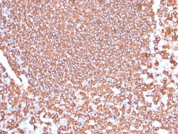 IHC testing of FFPE human tonsil tissue with recombinant CD20 antibody (clone IGEL/4524R). HIER: boil tissue sections in pH6, 10mM citrate buffer, for 20 min and allow to cool before testing.