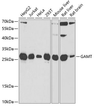 Anti-GAMT Antibody