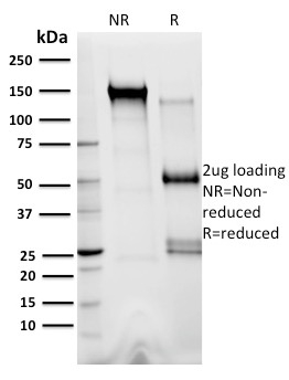 Anti-XRCC3 Antibody [10F1/6] - BSA and Azide free