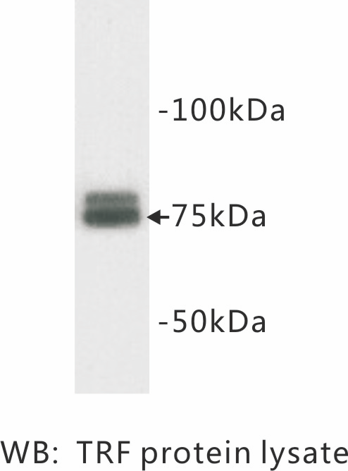 Anti-Transferrin Antibody [T25]
