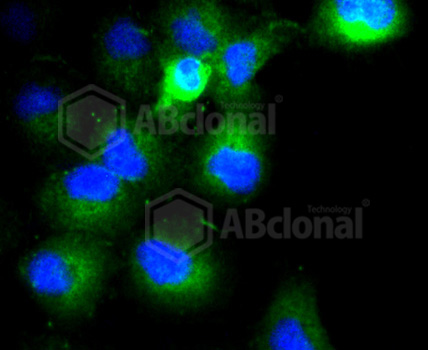 Anti-COL17A1 Antibody [Assigned #A10823]