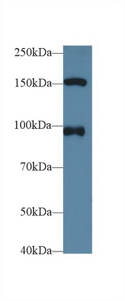 Western Blot; Sample: Human Hela cell lysate; <br/>Primary Ab: 1µg/ml Rabbit Anti-Human NUP98 Antibody<br/>Second Ab: 0.2µg/mL HRP-Linked Caprine Anti-Rabbit IgG Polyclonal Antibody<br/>(Catalog: SAA544Rb19)