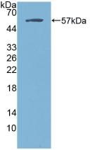 Western Blot; Sample: Recombinant ERa, Rat.