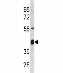 Txnip antibody western blot analysis in mouse stomach tissue lysate.