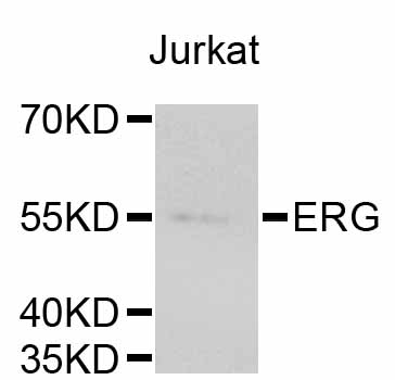 Anti-ERG Antibody [Assigned #A10855]