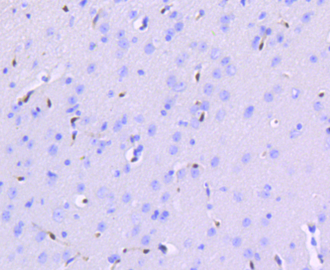 Anti-ERG Antibody [Assigned #A10855]