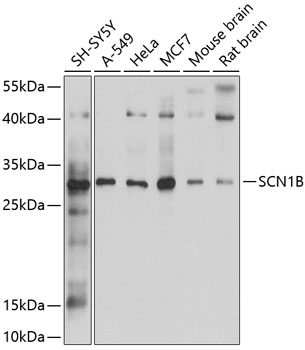 Anti-SCN1B Antibody