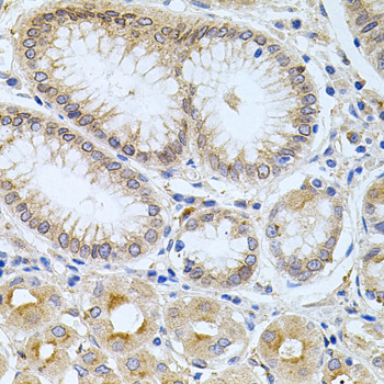 Anti-CPM Antibody