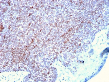 IHC staining of FFPE human skin with p73 antibody. HIER: boil tissue sections in pH 9 10mM Tris with 1mM EDTA for 20 min and allow to cool before testing.