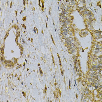Anti-CDA Antibody