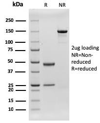 Anti-CD79b Antibody [rIGB/1842] - BSA and Azide free