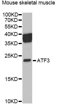 Anti-ATF3 Antibody