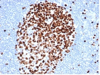 IHC staining of FFPE human tonsil tissue with recombinant Ki67 antibody (clone MKI67/4947R). HIER: boil tissue sections in pH 9 10mM Tris with 1mM EDTA for 20 min and allow to cool before testing.