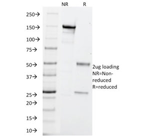 SDS-PAGE analysis of purified, BSA-free anti-UchL1 antibody (clone SPM575) as confirmation of integrity and purity.