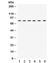 Western blot testing of 1) rat heart, 2) rat kidney, 3) rat brain, 4) human SMMC, 5) human PANC and 6) human A549 lysate with TRAP1 antibody. Expected molecular weight: 75-80 kDa.