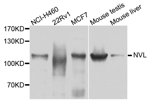 Anti-NVL Antibody