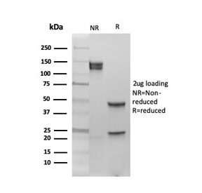 SDS-PAGE analysis of purified, BSA-free Estrogen Receptor beta 1 antibody (clone PGP5/10) as confirmation of integrity and purity.