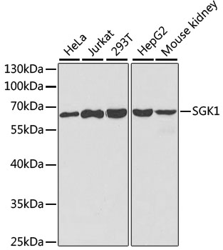 Anti-SGK1 Antibody