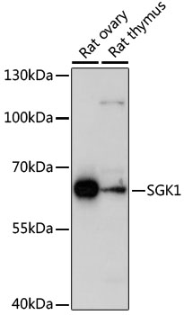 Anti-SGK1 Antibody