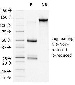 SDS-PAGE Analysis of Purified, BSA-Free b-Catenin Antibody (clone 9F2). Confirmation of Integrity and Purity of the Antibody.