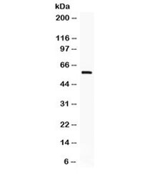 Western blot testing of human HeLa cell lysate with IKAROS antibody. Expected molecular weight: ~65/55 kDa (isoforms 1/2). (Ref 1)