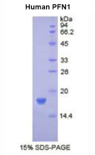 Figure. SDS-PAGE